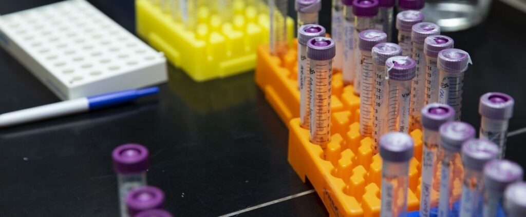 Coronavirus in Italia, il bollettino del 29 aprile 14.320 nuovi casi