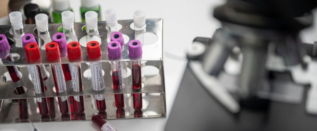 Coronavirus in Italia, il bollettino dell’8 aprile 17.221 nuovi casi
