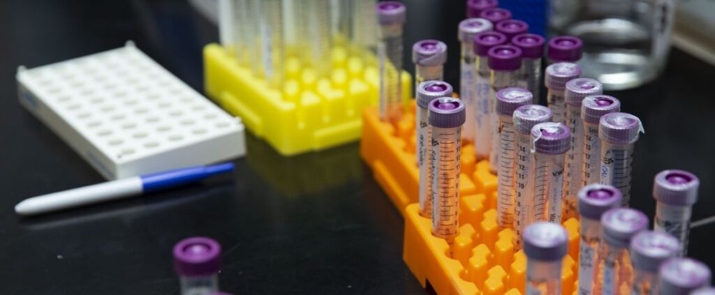 Coronavirus in Italia, il bollettino del 10 maggio 5.080 nuovi casi