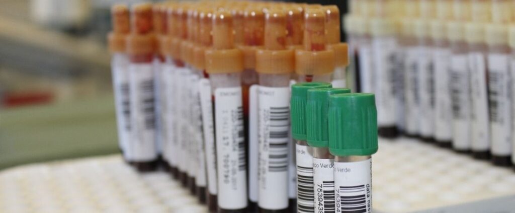 Coronavirus in Italia, il bollettino del 31 maggio