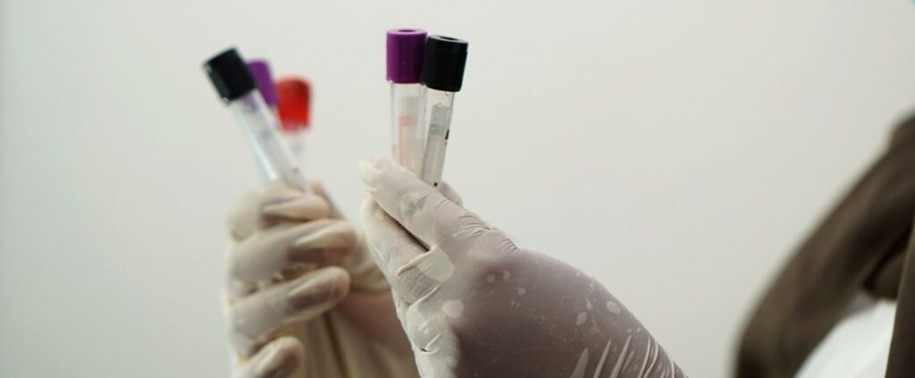 Coronavirus in Italia, il bollettino del 1° giugno