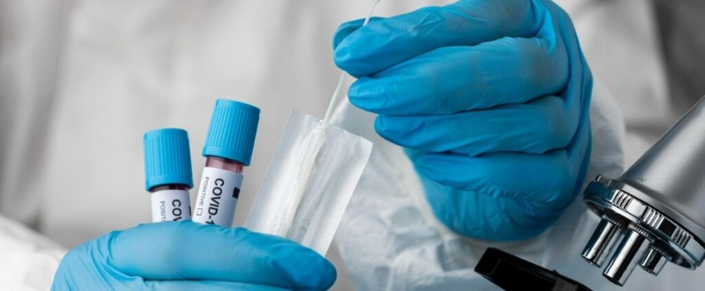 Coronavirus in Italia, il bollettino del 30 giugno 776 nuovi casi