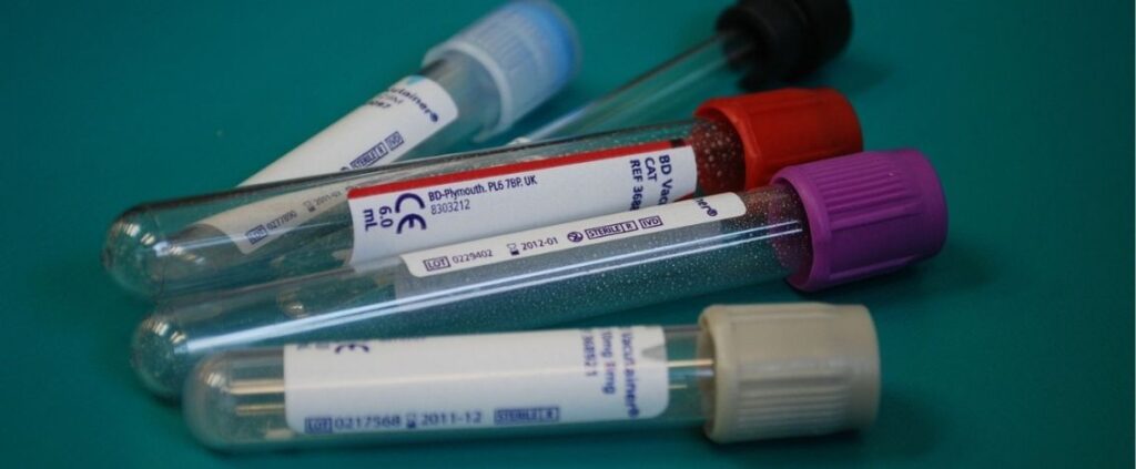Coronavirus in Italia, il bollettino del 4 giugno