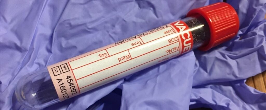 Coronavirus in Italia, il bollettino del 5 giugno 2.436 nuovi casi