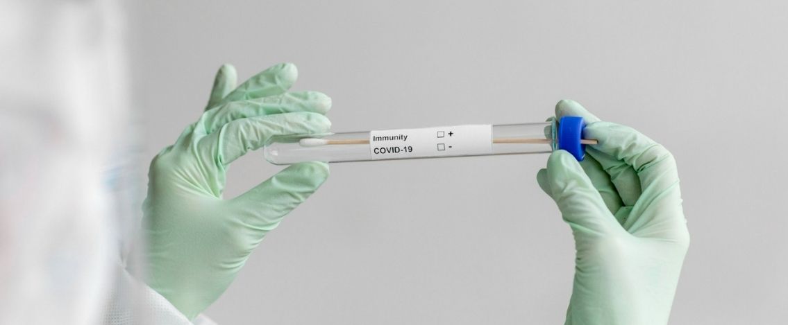 Coronavirus in Italia, il bollettino del 19 luglio 2.072 nuovi casi
