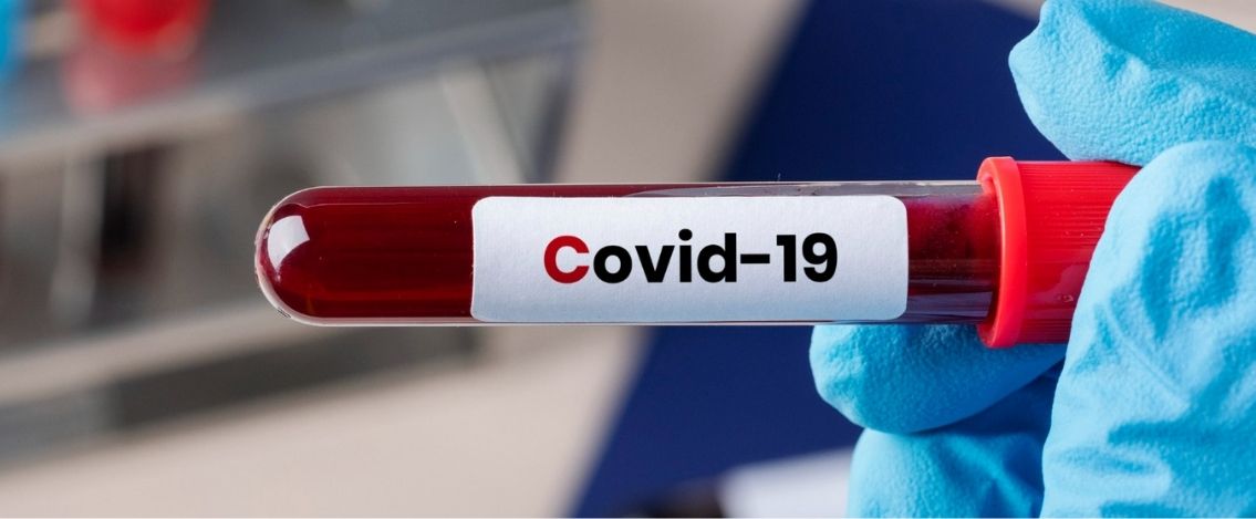 Coronavirus in Italia, il bollettino del 1° luglio 882 nuovi casi