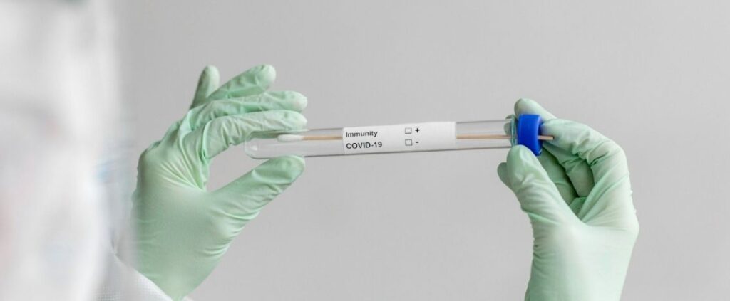 Coronavirus in Italia, il bollettino del 3 agosto 4.845 nuovi casi
