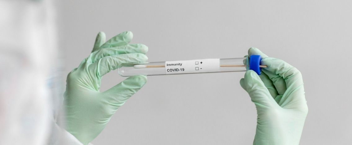 Coronavirus in Italia, il bollettino del 3 agosto 4.845 nuovi casi