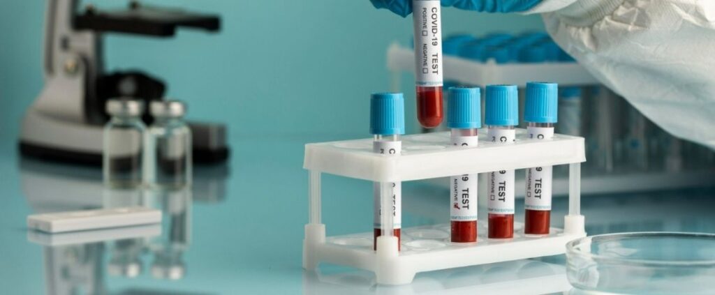 Vaccino contro le varianti Covid, ecco a che punto è la ricerca